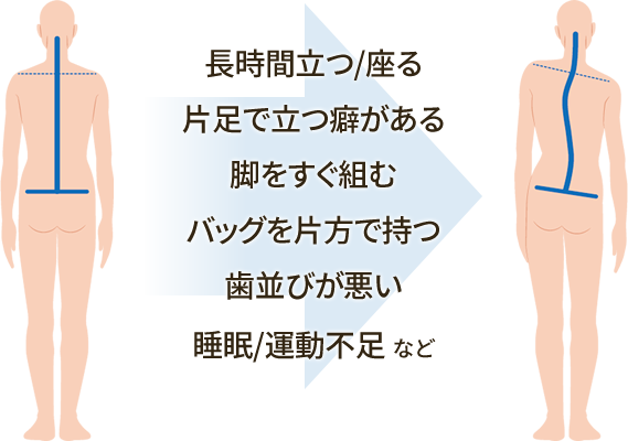 バランスが崩れる原因はさまざま